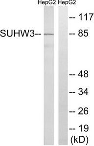 Western blot analysis of extracts from HepG2 cells, using ZNF280C antibody.The lane on the right is treated with the synthesized peptide.