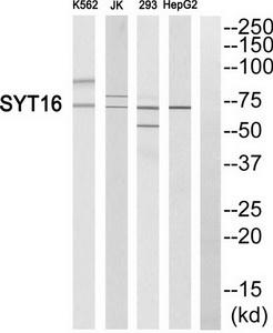 Western blot analysis of extracts from K562 cells, Jurkat cells, 293 cells and HepG2 cells, using SYT16 antibody.The lane on the right is treated with the synthesized peptide.
