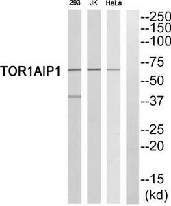 Western blot analysis of extracts from 293 cells, Jurkat cells and HeLa cells, using TOR1AIP1 antibody.The lane on the right is treated with the synthesized peptide.