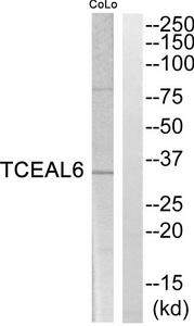 Western blot analysis of extracts from CoLo cells, using TCEAL6 Antibody.The lane on the right is treated with the synthesized peptide.
