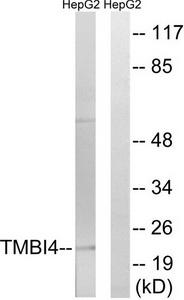Western blot analysis of extracts from HepG2 cells, using TMBIM4 antibody.The lane on the right is treated with the synthesized peptide.