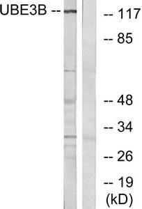 Western blot analysis of extracts from Jurkat cells, using UBE3B antibody.The lane on the right is treated with the synthesized peptide.