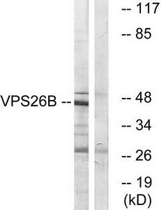 Western blot analysis of extracts from LOVO cells, using VP26B antibody.The lane on the right is treated with the synthesized peptide.