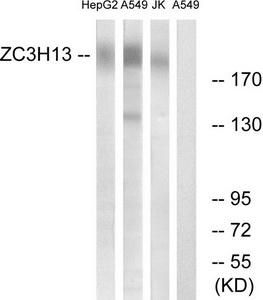 Western blot analysis of extracts from HepG2 cells, A549 cells and Jurkat cells, using ZC3H13 antibody.The lane on the right is treated with the synthesized peptide.