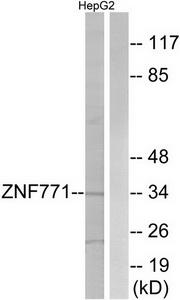 Western blot analysis of extracts from HepG2 cells, using ZNF771 antibody.The lane on the right is treated with the synthesized peptide.
