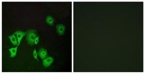 Immunofluorescence analysis of A549 cells, using TTF2 antibody.The picture on the right is treated with the synthesized peptide.