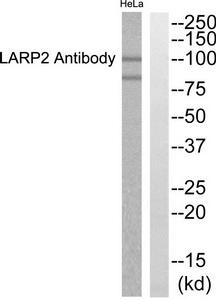 Western blot analysis of extracts from Hela cells, using LARP2 Antibody.The lane on the right is treated with the synthesized peptide.