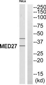 Western blot analysis of extracts from HeLa cells, using MED27 antibody.The lane on the right is treated with the synthesized peptide.