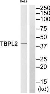 Western blot analysis of extracts from HeLa cells, using TBPL2 antibody.The lane on the right is treated with the synthesized peptide.