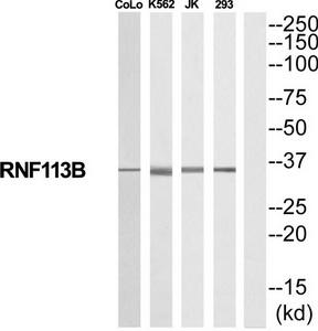Western blot analysis of extracts from COLO205/K562/Jurkat/293 cells, using RNF113B antibody.The lane on the right is treated with the synthesized peptide.