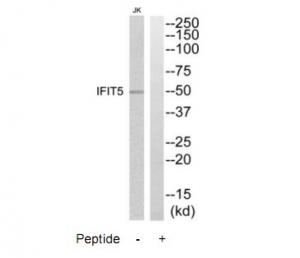 Western blot analysis of extracts from Jurkat cells, using IFIT5 antibody.The lane on the right is treated with the synthesized peptide.