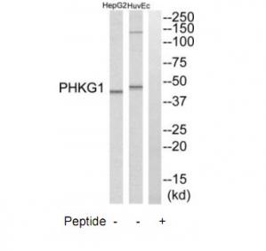 WB using the antibody against H3K79me2 diluted 1:250 in TBS-Tween containing 5% skimmed milk. The position of the protein of interest is indicated on the left; the marker (in kDa) is shown on the right.