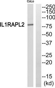 Western blot analysis of MYPT1 expression in NIH/3T3 cell extract