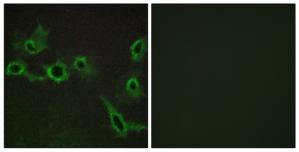 Immunofluorescence analysis of COS-7 cells, using HTR7 antibody.The picture on the right is treated with the synthesized peptide.