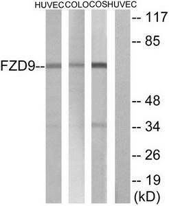 Western blot analysis of extracts from HUVEC cells COLO cells and COS cells, using FZD9 antibody.The lane on the right is treated with the synthesized peptide.