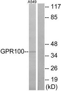 Western blot analysis of extracts from A549 cells, using GPR100 antibody.The lane on the right is treated with the synthesized peptide.