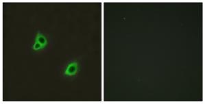 Immunofluorescence analysis of HuvEc cells, using GPR126 antibody.The picture on the right is treated with the synthesized peptide.