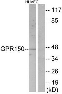 Western blot analysis of extracts from HUVEC cells, using GPR150 antibody.The lane on the right is treated with the synthesized peptide.