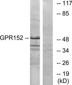 Western blot analysis of extracts from Jurkat cells, using GPR152 antibody.The lane on the right is treated with the synthesized peptide.