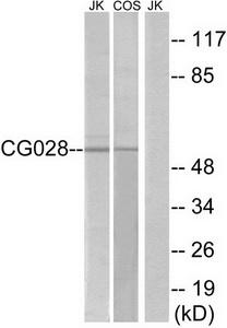 Western blot analysis of extracts from Jurkat cells and COS cells, using CG028 antibody.The lane on the right is treated with the synthesized peptide.