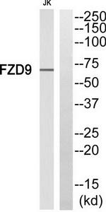 Western blot analysis of extracts from Jurkat cells, using FZD9 antibody.The lane on the right is treated with the synthesized peptide.