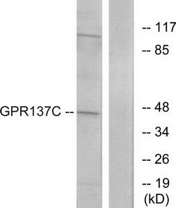 Western blot analysis of extracts from HepG2 cells, using GPR137C antibody.The lane on the right is treated with the synthesized peptide.