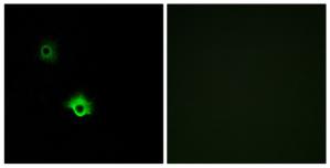 Immunofluorescence analysis of A549 cells, using GALR3 antibody.The picture on the right is treated with the synthesized peptide.