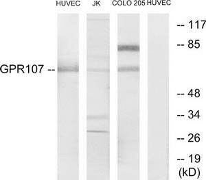 Western blot analysis of CRBN in human testis tissue lysate with CRBN antibody at (A) 0.5 and (B) 1ug/mL.