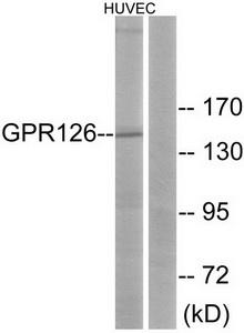 Western blot analysis of extracts from HUVEC cells, using GPR126 antibody.The lane on the right is treated with the synthesized peptide.