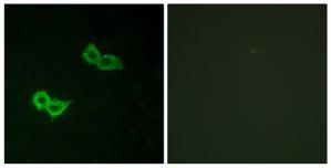 Immunofluorescence analysis of HepG2 cells, using GPR150 antibody.The picture on the right is treated with the synthesized peptide.
