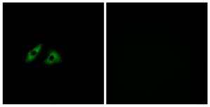 Immunofluorescence analysis of HeLa cells, using GPR152 antibody.The picture on the right is treated with the synthesized peptide.