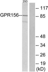 Western blot analysis of extracts from 293 cells, using GPR156 antibody.The lane on the right is treated with the synthesized peptide.