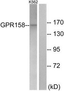 Western blot analysis of extracts from K562 cells, using GPR158 antibody.The lane on the right is treated with the synthesized peptide.
