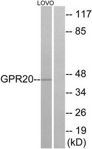 Western blot analysis of extracts from LOVO cells, using GPR20 antibody.The lane on the right is treated with the synthesized peptide.