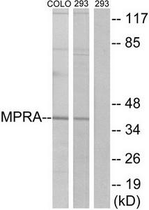 Western blot analysis of extracts from 293 cells and COLO cells, using MPRA antibody.The lane on the right is treated with the synthesized peptide.