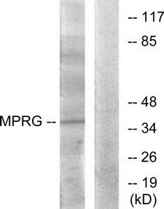 Western blot analysis of extracts from HUVEC cells, using MPRG antibody.The lane on the right is treated with the synthesized peptide.