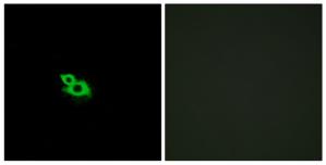 Immunofluorescence analysis of MCF-7 cells, using OR2A42 antibody.The picture on the right is treated with the synthesized peptide.
