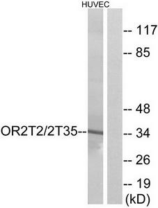 Western blot analysis of extracts from HUVEC cells, using OR2T2/2T35 antibody.The lane on the right is treated with the synthesized peptide.