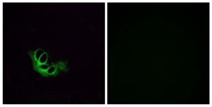 Immunofluorescence analysis of HeLa cells, using OR56A1 antibody.The picture on the right is treated with the synthesized peptide.