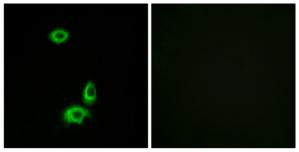 Immunofluorescence analysis of HuvEc cells, using OR56B1 antibody.The picture on the right is treated with the synthesized peptide.