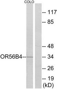 Western blot analysis of extracts from COLO cells, using OR56B4 antibody.The lane on the right is treated with the synthesized peptide.