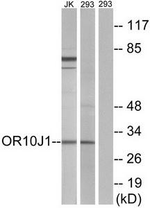 Western blot analysis of extracts from Jurkat cells and 293 cells, using OR10J1 antibody.The lane on the right is treated with the synthesized peptide.
