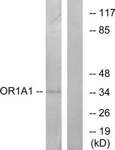 Western blot analysis of extracts from COLO cells, using OR1A1 antibody.The lane on the right is treated with the synthesized peptide.