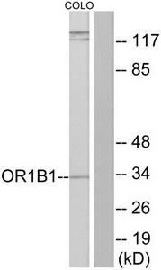 Western blot analysis of extracts from COLO cells, using OR1B1 antibody.The lane on the right is treated with the synthesized peptide.