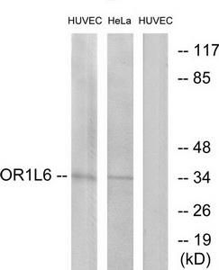 Western blot analysis of extracts from HUVEC cells and HeLa cells, using OR1L6 antibody.The lane on the right is treated with the synthesized peptide.