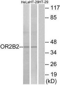 Western blot analysis of extracts from HeLa cells and HT-29 cells, using OR2B2 antibody.The lane on the right is treated with the synthesized peptide.