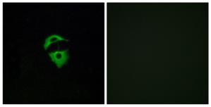 Immunofluorescence analysis of A549 cells, using OR2D2 antibody.The picture on the right is treated with the synthesized peptide.