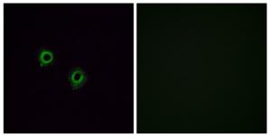 Immunofluorescence analysis of A549 cells, using OR2J3 antibody.The picture on the right is treated with the synthesized peptide.