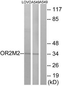 Western blot analysis of extracts from LOVO cells and A549 cells, using OR2M2 antibody.The lane on the right is treated with the synthesized peptide.