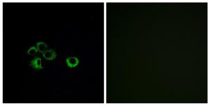 Immunofluorescence analysis of MCF-7 cells, using OR2Z1 antibody.The picture on the right is treated with the synthesized peptide.